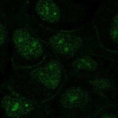 Immunocytochemistry/ Immunofluorescence: OR1N2 Antibody [NBP3-17611]