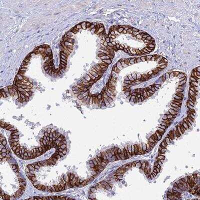 Immunohistochemistry-Paraffin: OR1Q1 Antibody [NBP1-92224]