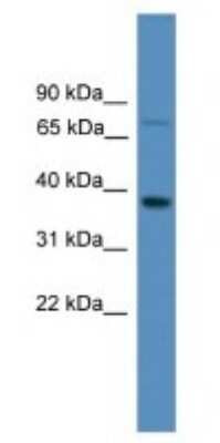 Western Blot: OR1S1 Antibody [NBP1-69090]