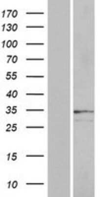 Western Blot: OR2A25 Overexpression Lysate [NBP2-08886]