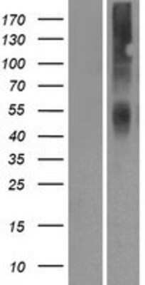 Western Blot: OR2A42 Overexpression Lysate [NBP2-08958]