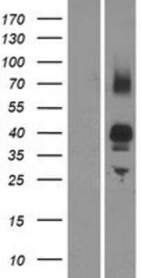 Western Blot: OR2AG1 Overexpression Lysate [NBP2-08887]