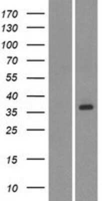 Western Blot: OR2AG2 Overexpression Lysate [NBP2-08888]