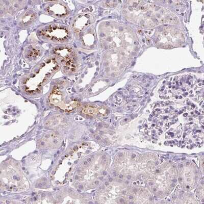 Immunohistochemistry: OR2AK2 Antibody [NBP2-49048]