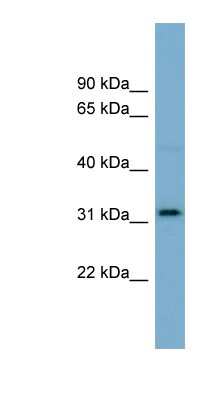 Western Blot: OR2AT4 Antibody [NBP1-59861]