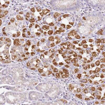 Immunohistochemistry-Paraffin: OR2B11 Antibody [NBP1-92225]