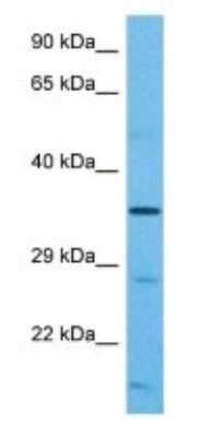 Western Blot: OR2B2 Antibody [NBP3-09389]