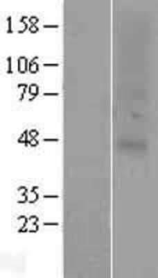 Western Blot: OR2C1 Overexpression Lysate [NBP2-07455]