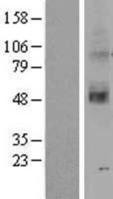 Western Blot: OR2C3 Overexpression Lysate [NBP2-04743]