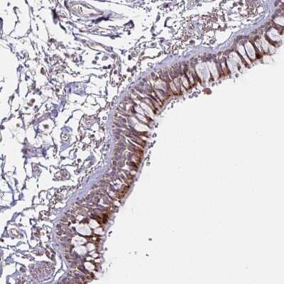 Immunohistochemistry: OR2D3 Antibody [NBP2-49049]