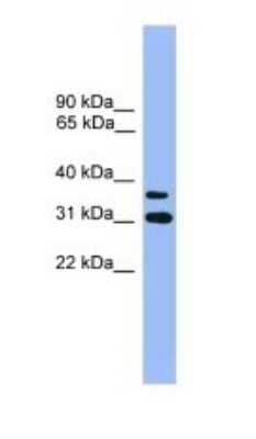 Western Blot: OR2D3 Antibody [NBP1-69086]