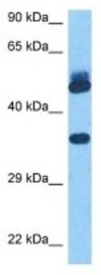 Western Blot: OR2G2 Antibody [NBP3-11000]