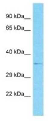 Western Blot: OR2G6 Antibody [NBP3-09769]