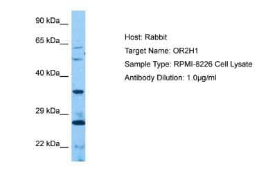 Western Blot: OR2H1 Antibody [NBP2-86738]