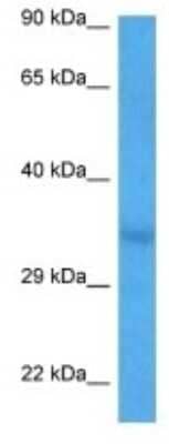 Western Blot: OR2H2 Antibody [NBP3-09987]