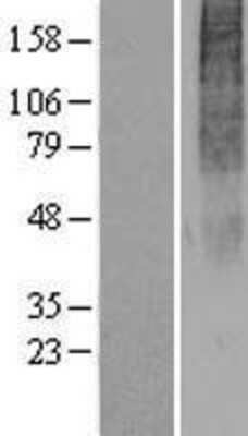 Western Blot: OR2H2 Overexpression Lysate [NBP2-07526]