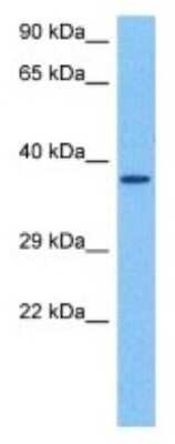 Western Blot: OR2J2 Antibody [NBP3-10004]