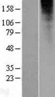 Western Blot: OR2L13 Overexpression Lysate [NBP2-05045]