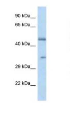 Western Blot: OR2L8 Antibody [NBP1-79773]