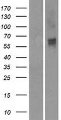 Western Blot: OR2M2 Overexpression Lysate [NBP2-08889]