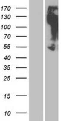 Western Blot: OR2M3 Overexpression Lysate [NBP2-08890]