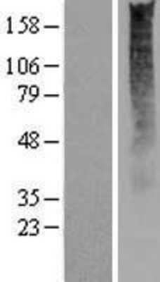 Western Blot: OR2S2 Overexpression Lysate [NBP2-06697]