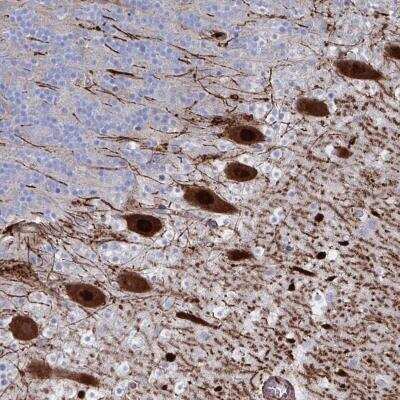 Immunohistochemistry-Paraffin: OR2T1 Antibody [NBP2-32375]