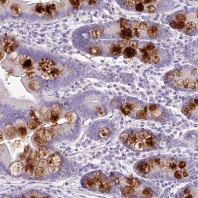 Immunohistochemistry-Paraffin: OR2T10 Antibody [NBP2-13696]