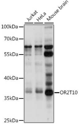 Western Blot: OR2T10 AntibodyAzide and BSA Free [NBP2-94439]