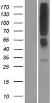 Western Blot: OR2T12 Overexpression Lysate [NBP2-08891]