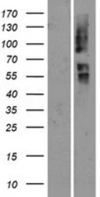 Western Blot: OR2T29 Overexpression Lysate [NBP2-08892]