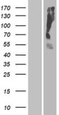 Western Blot: OR2T35 Overexpression Lysate [NBP2-08959]