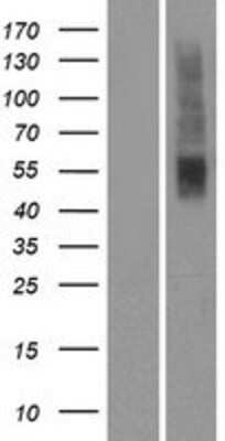 Western Blot: OR2T5 Overexpression Lysate [NBP2-08893]