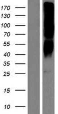 Western Blot: OR2T8 Overexpression Lysate [NBP2-08844]