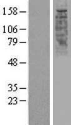 Western Blot: OR2W1 Overexpression Lysate [NBP2-06171]