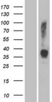 Western Blot: OR2W3 Overexpression Lysate [NBP2-08965]