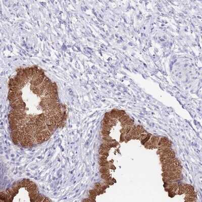 Immunohistochemistry-Paraffin: OR2Z1 Antibody [NBP2-13698]