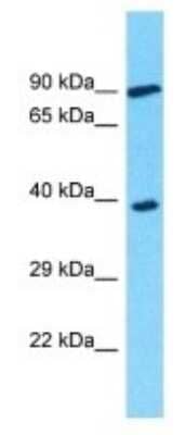 Western Blot: OR3A2 Antibody [NBP3-09776]