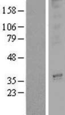 Western Blot: OR3A2 Overexpression Lysate [NBP2-08100]