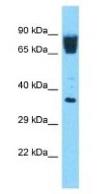 Western Blot: OR3A3 Antibody [NBP3-09739]