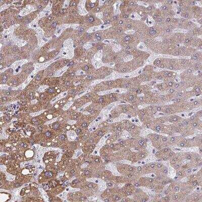 Immunohistochemistry-Paraffin: OR4A47 Antibody [NBP2-32493]