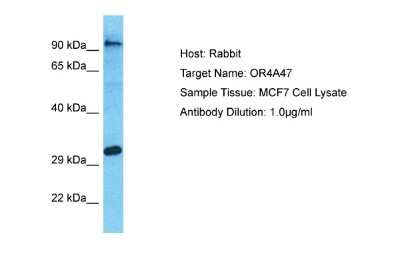 Western Blot: OR4A47 Antibody [NBP2-83316]