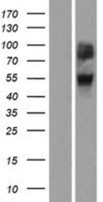 Western Blot: OR4A47 Overexpression Lysate [NBP2-08842]