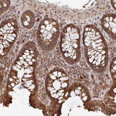 Immunohistochemistry-Paraffin: OR4C15 Antibody [NBP2-32355]