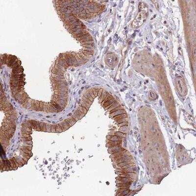 Immunohistochemistry-Paraffin: OR4C3 Antibody [NBP2-13699]