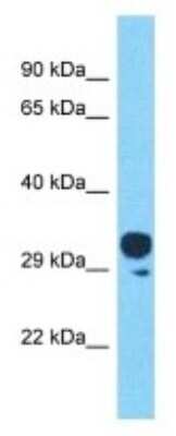 Western Blot: OR4C45 Antibody [NBP3-09781]