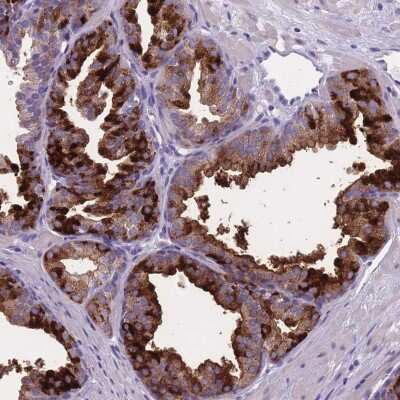 Immunohistochemistry-Paraffin: OR4C5 Antibody [NBP2-33571]