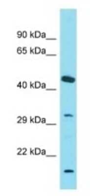 Western Blot: OR4C6 Antibody [NBP3-09659]