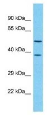 Western Blot: OR4D1 Antibody [NBP3-09782]