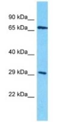 Western Blot: OR4D10 Antibody [NBP3-09784]